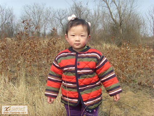 被冻伤的左脸，好可怜哦!